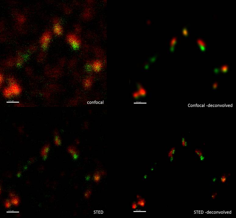 In June 2012 SVI entered the super resolution field by announcing the new Huygens STED deconvolution. The above picture depicts a comparision of confocal and STED images, before and after deconvolution with Huygens.
Signal shows regulatory proteins Dmc1 and Rad51 for DNA repair during homologous chromosome recombination in meiosis. Dmc1 shown in green: Mega 520 - 532/685 for ex/em and 770 for depletion. Rad51 shown in red: Atto 647 640/685 ex/em and 770 for depletion. Courtesy of Dr. Juraj Kabat (Biological Imaging Facility, NIH/NIAID, Bethesda, USA).