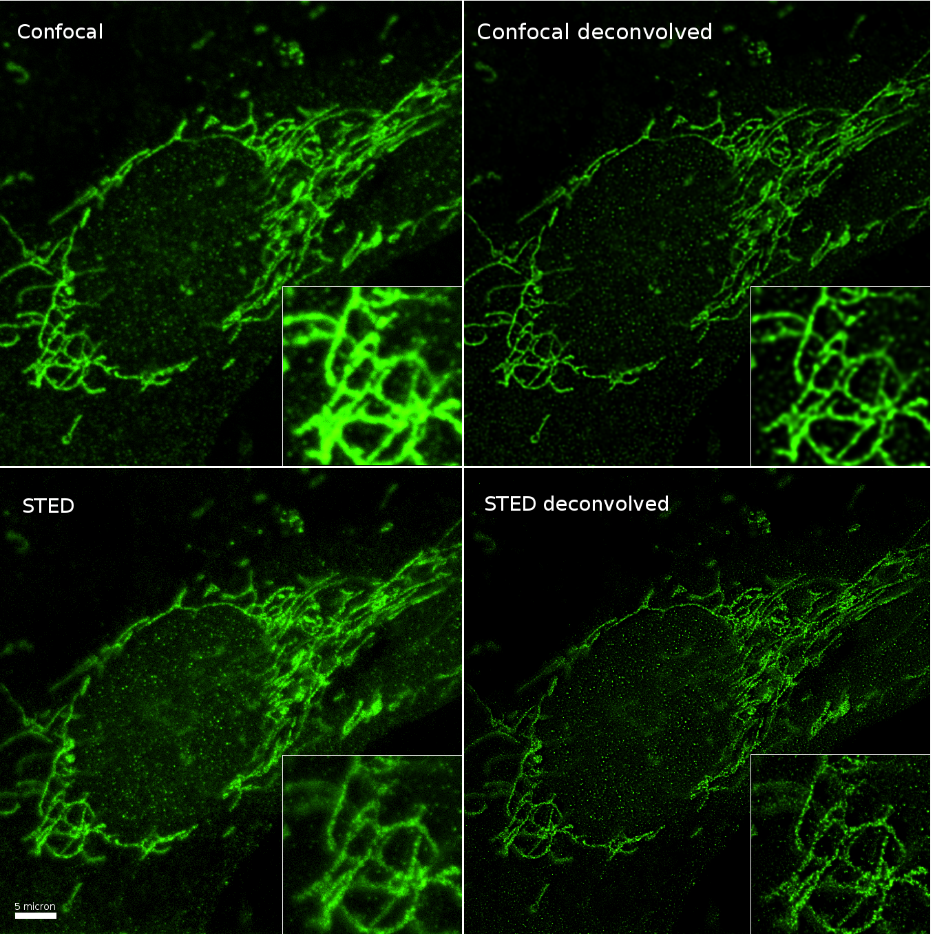 Series049_Confocal_STED_Raw_and_decon_Figure.png