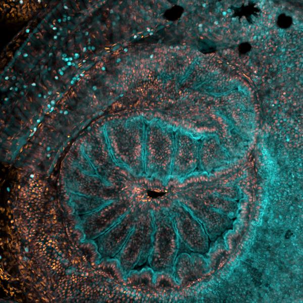 Huygens deconvolved and MIP rendered confocal image (Nikon; NA 0.45) of a tadpole intestine with nuclei in orange and muscle actin in cyan. The direction of the gut looping can be used as a readout for proper asymmetric organ development. Looping in the other direction is a sign of perturbed Nodal/Notch signaling.