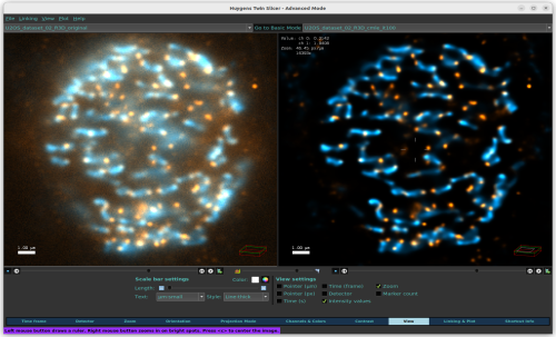 Raw (left) and deconvolved (right) versions of an image can be easily compared in the TwinSlicer
