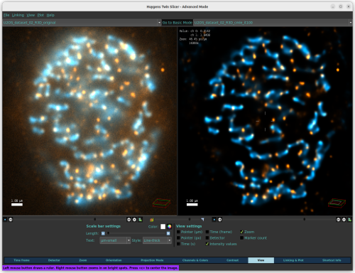 Raw (right) and deconvolved (left) versions of an image can be easily compared in the TwinSlicer