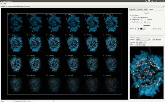 Gallery showing 45 slices of a Z-stack image and a zoomed view of one selected slice.