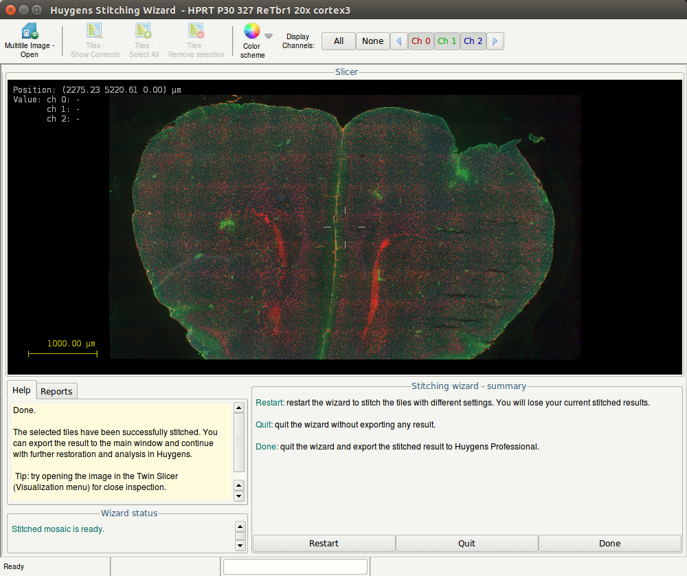 Huygens Stitching Wizard  - HPRT P30 327 ReTbr1 20x cortex3_005.png