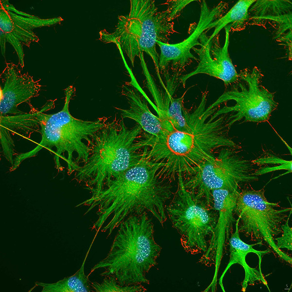 Helfrid Hochegger, Image Contest 2015