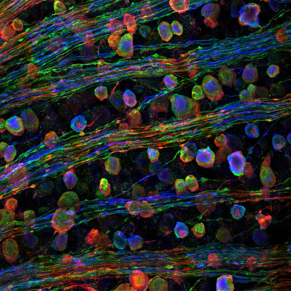 Calbindin immunoreactivity in the ganglion cell layer of a mouse retina. The image was taken close to the center of the retina, where the ganglion cell axons gather in thick bundles and then leave the eye as the optic nerve. This confocal stack was recorded on a Leica SP8 microscope, deconvolved using Huygens Essential, and finally color-coded for depth.