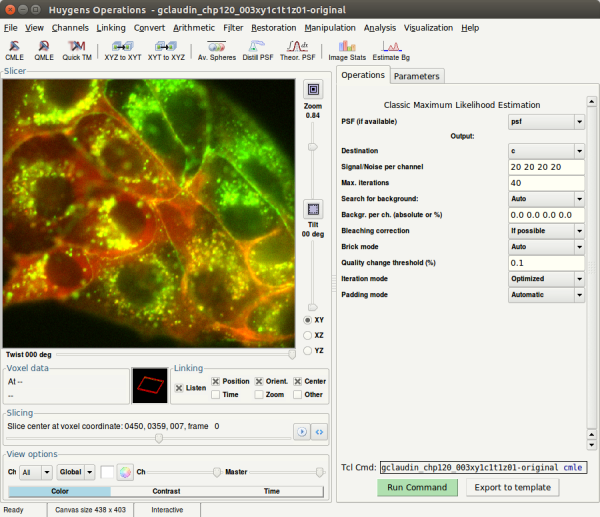 The Operation Window allows multichannel deconvolution in one run with all deconvolution parameters at hand