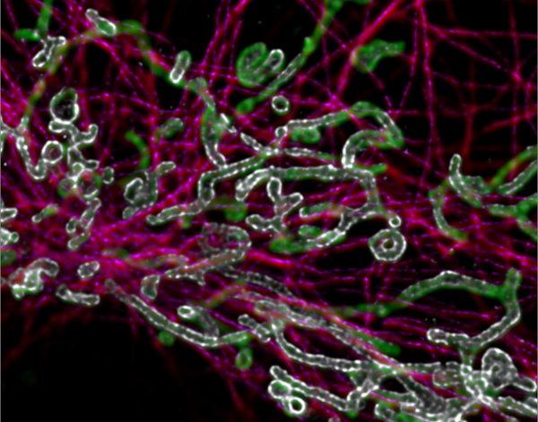 Daniela Malide Image Contest 2016, winner