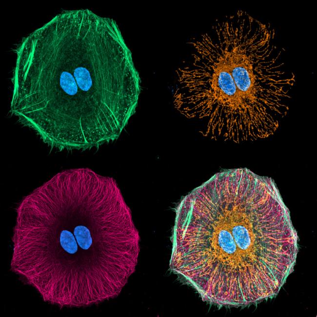 Hela cell stained for DNA (Azure), F-Actin (Spring Green), Mitochondria (Amber) and Tubulin (Bright Pink). Confocal images were taken with a Zeiss LSM710 microscope and deconvolved with Huygens software.