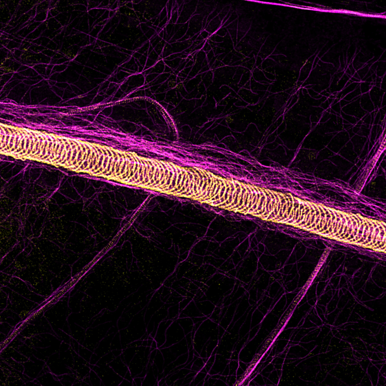 Tubulin Tracheoles Wiki