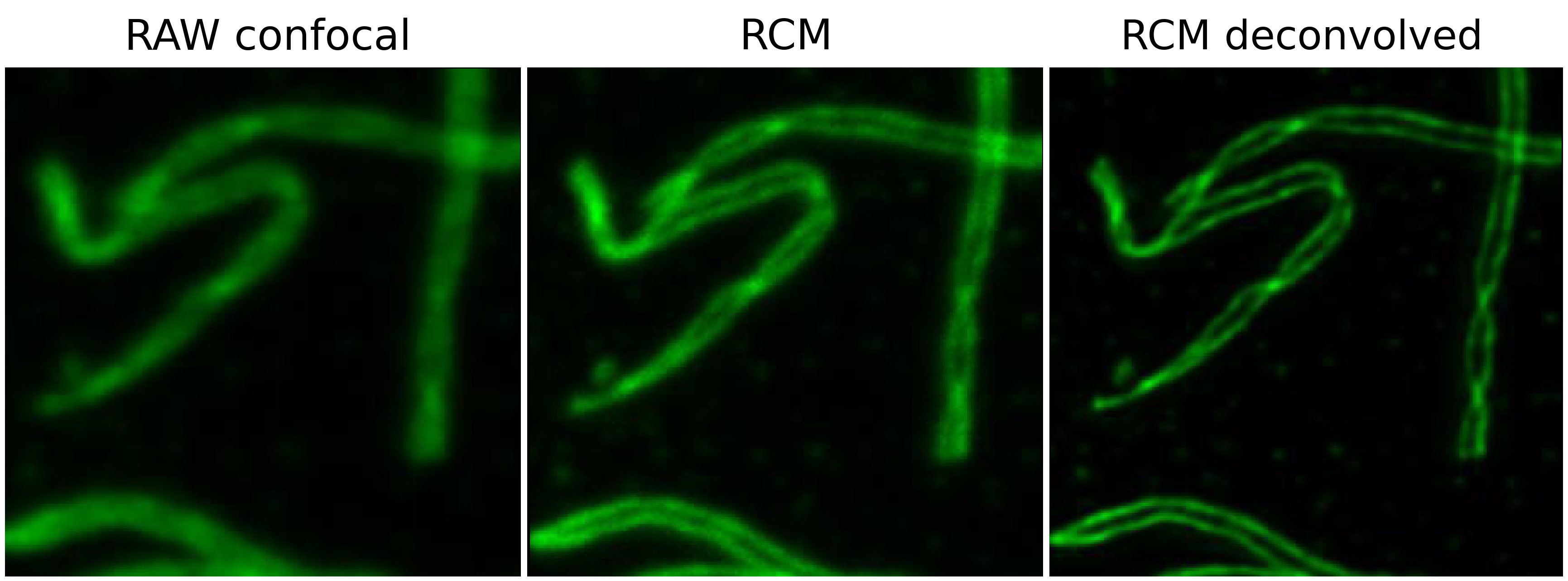 Confocal RCM Decon Meiosis Highres WithText