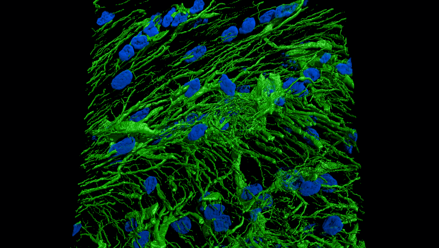 McortesCanteli3 SFP Isosurface