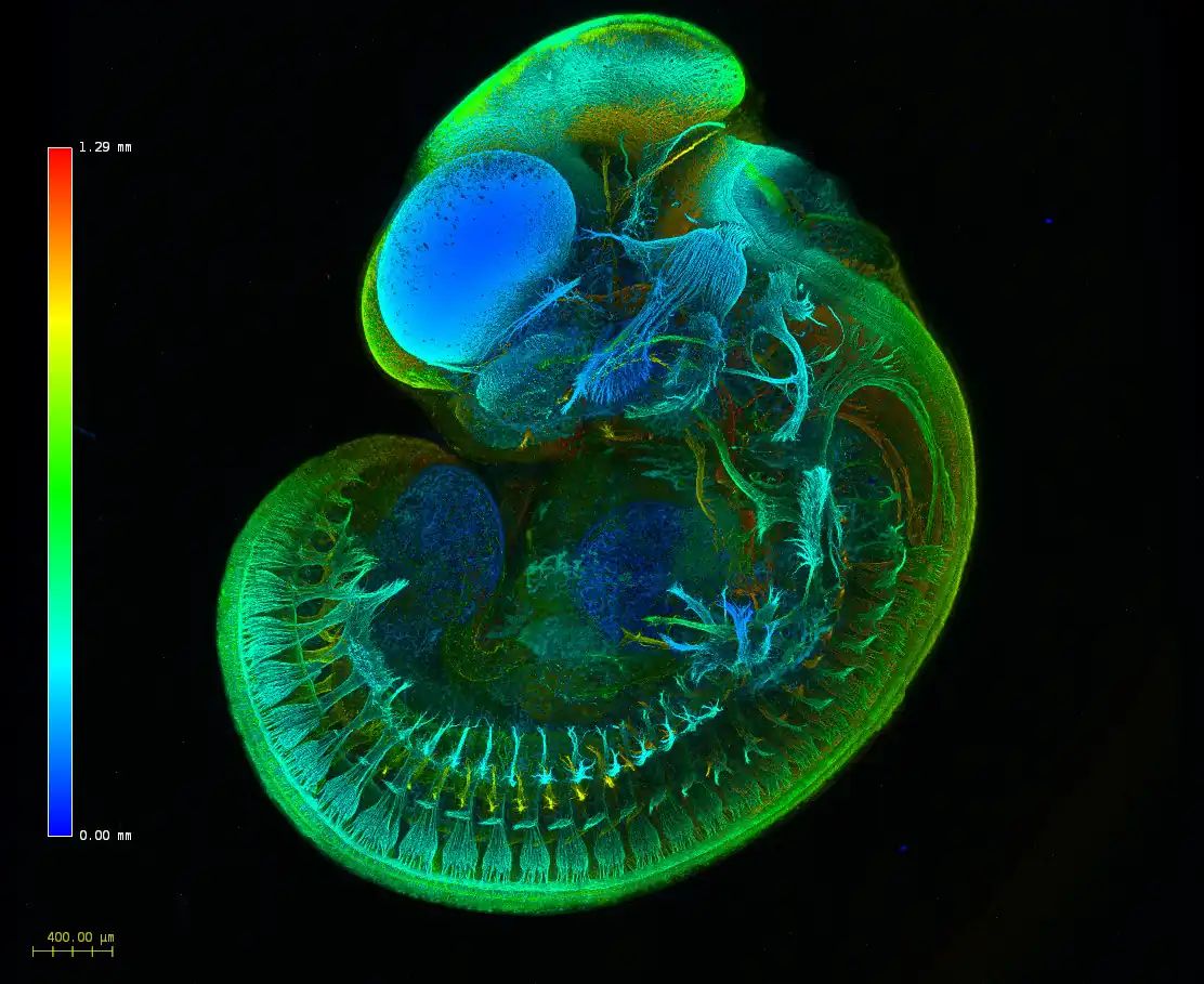 ZhiyeLu DM XM IDISCO Cleared Mouse Embryo Nerve System Confocal Depthcoded Website