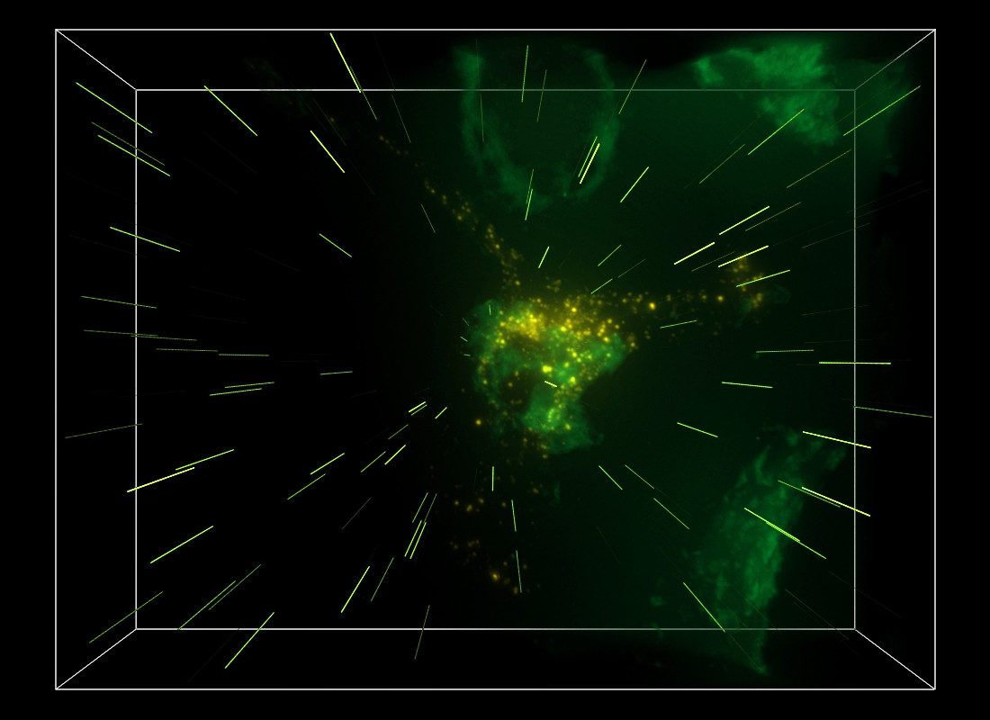 Hot pixels appear as vertical lines in a MIP projection of a 3D image. Image is courtesy of Dr. Rebecca Lee and Genevieve Phillips, Fluorescence Microscopy Shared Resource, University of New Mexico School of Medicine, Albuquerque, USA.