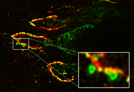 Example Clipping Decon V2