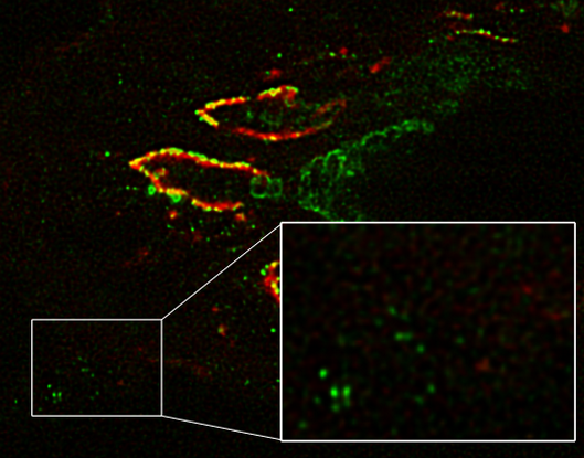 SNR Drawbacks Image Decon
