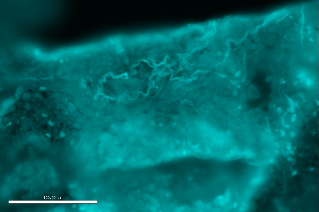 Autofluorescence Channel Crop2