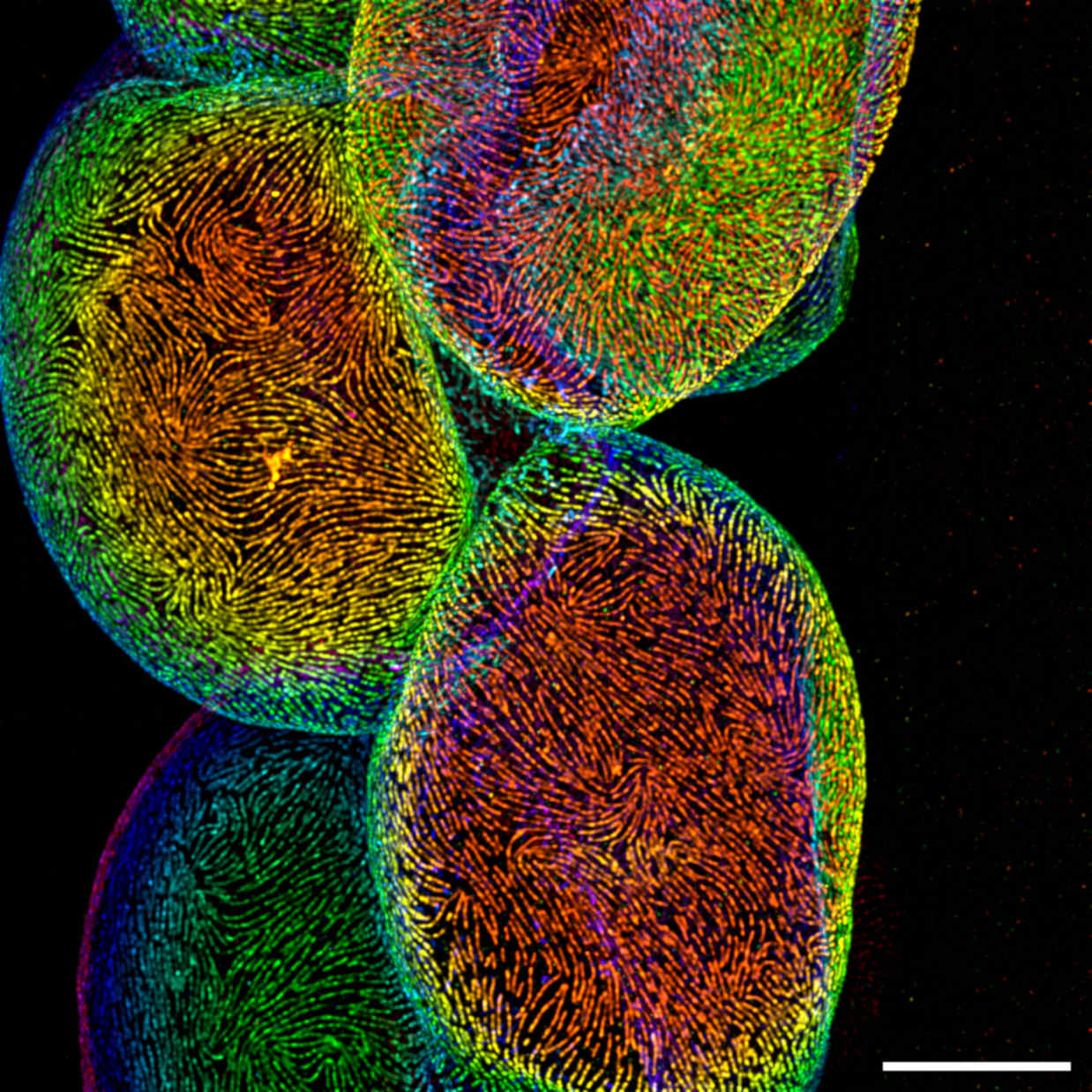 Depth Encoded Coloring Nephros 3D Scale Bar 10 µm 620 Website