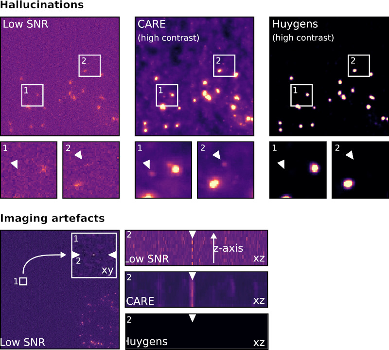 Hallucination And Imaging Artefacts