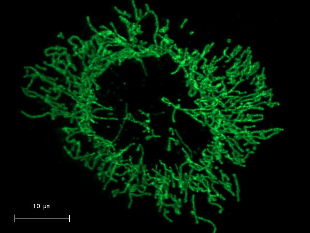 HeLa TOM20 MeGFP Decon Rotated