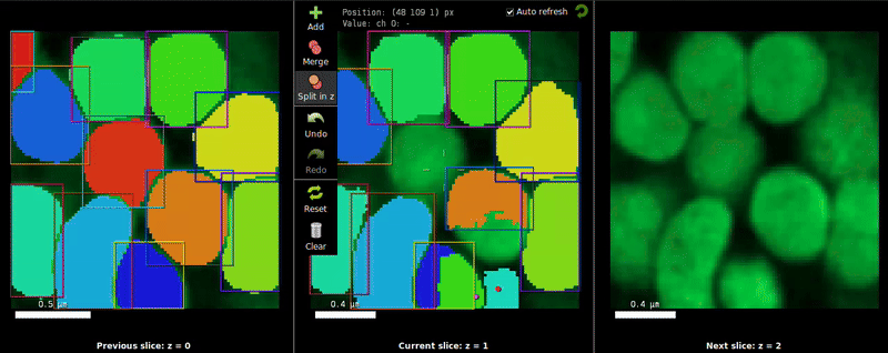 Adjustingsegmentation3D