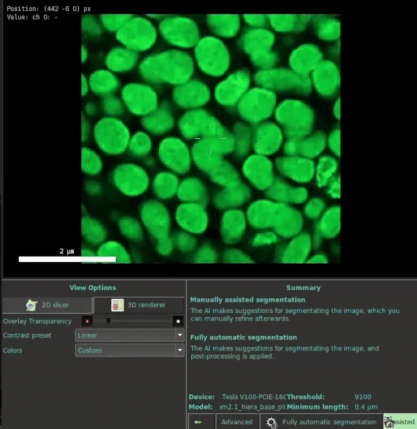 Automatic Segmentation UI Update