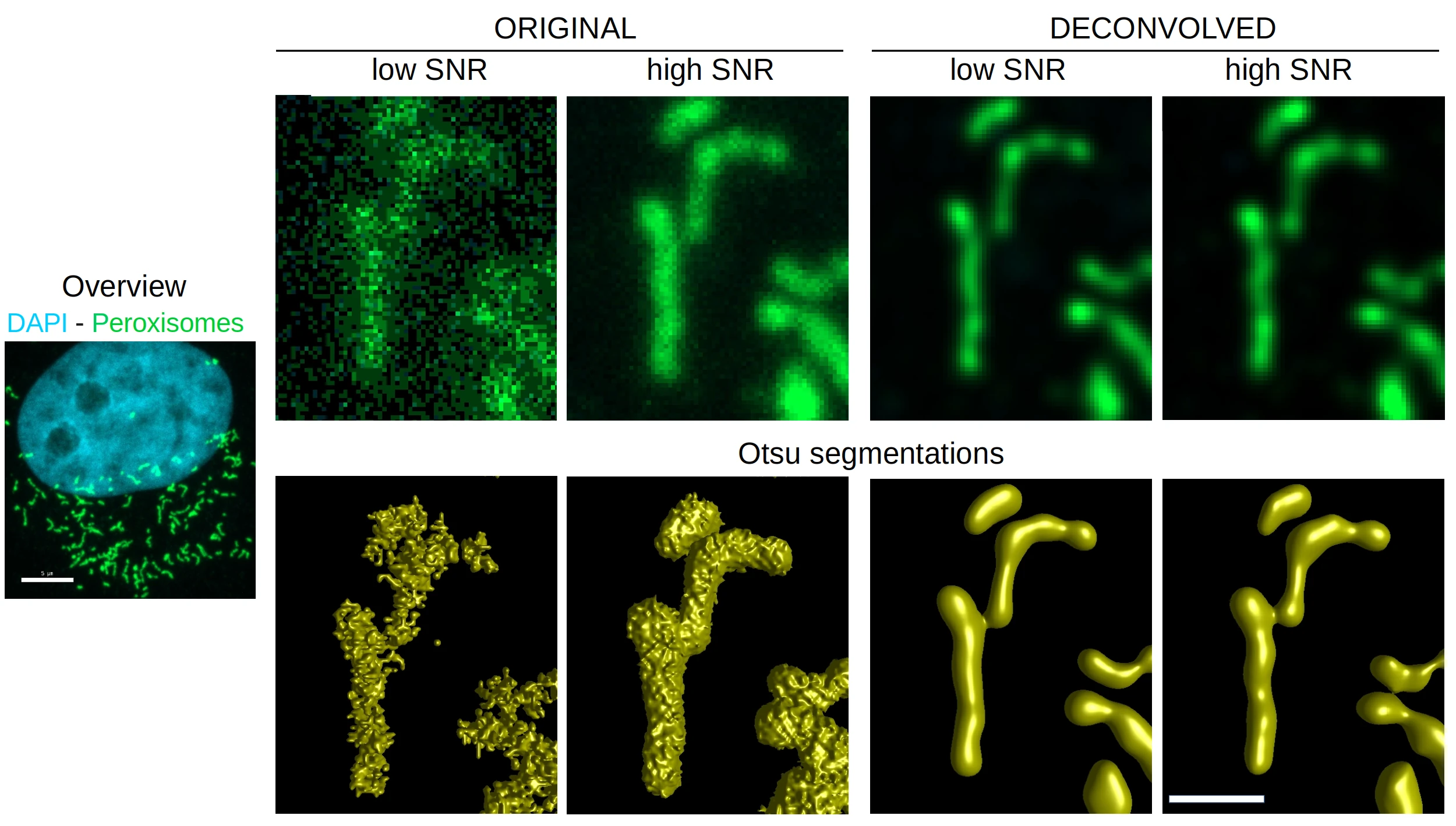 Peroxisomes Decon Otsu